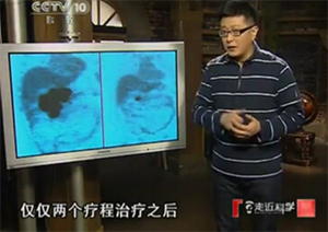 G&mdash;B����Ѫ���������Ʒ��߽�����